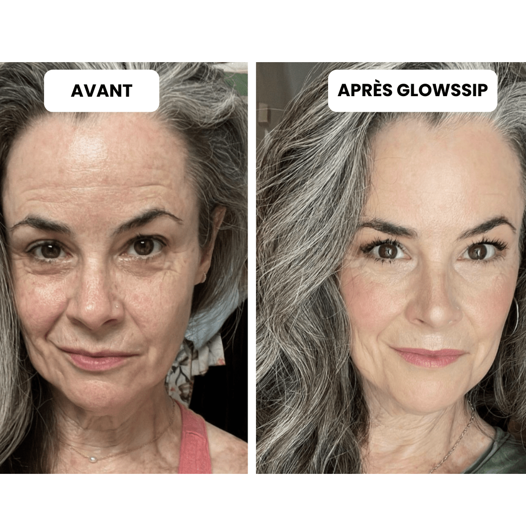 Micro Infusion 3 Mois + 2 Cadeaux Offerts