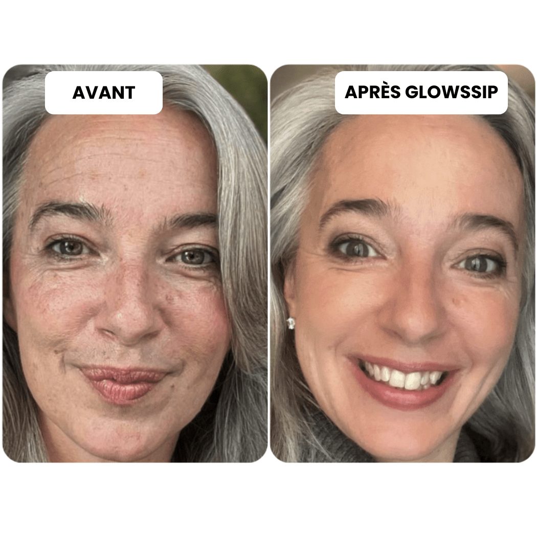 Micro Infusion 3 Mois + 2 Cadeaux Offerts