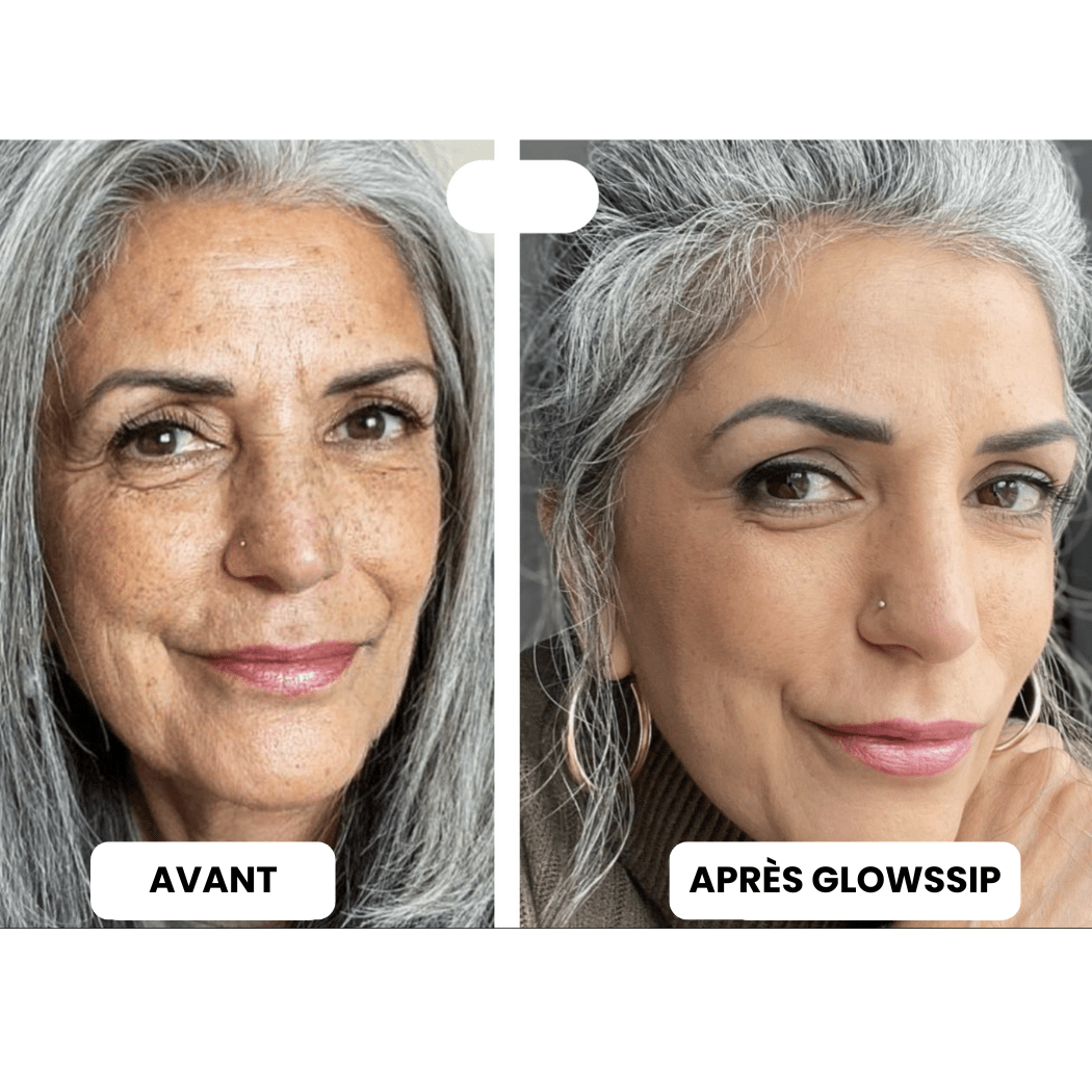 Micro Infusion 3 Mois + 2 Cadeaux Offerts