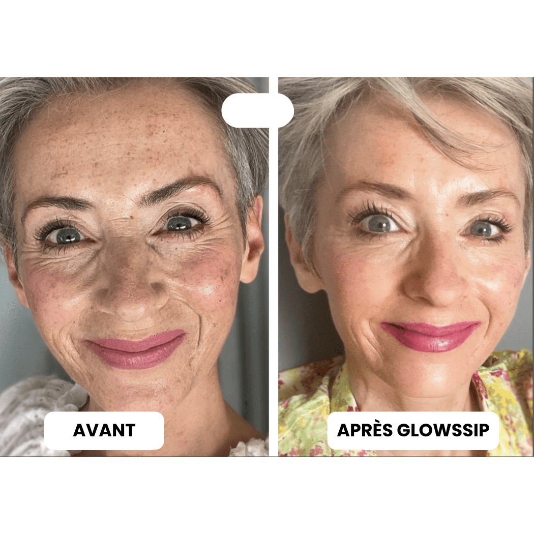 Micro Infusion 3 Mois + 2 Cadeaux Offerts