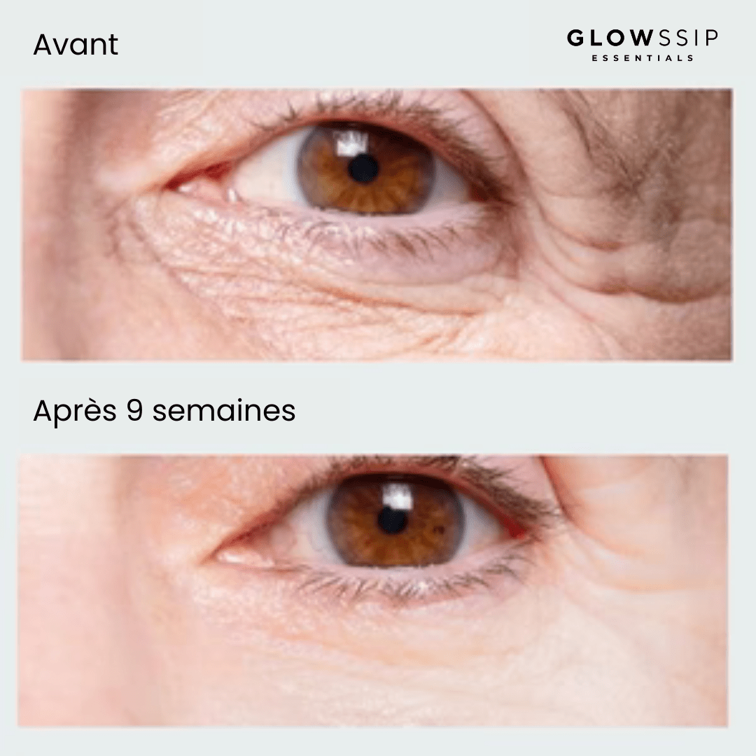 Pack 6 Patches Micro Infusion Ultra-Ciblés