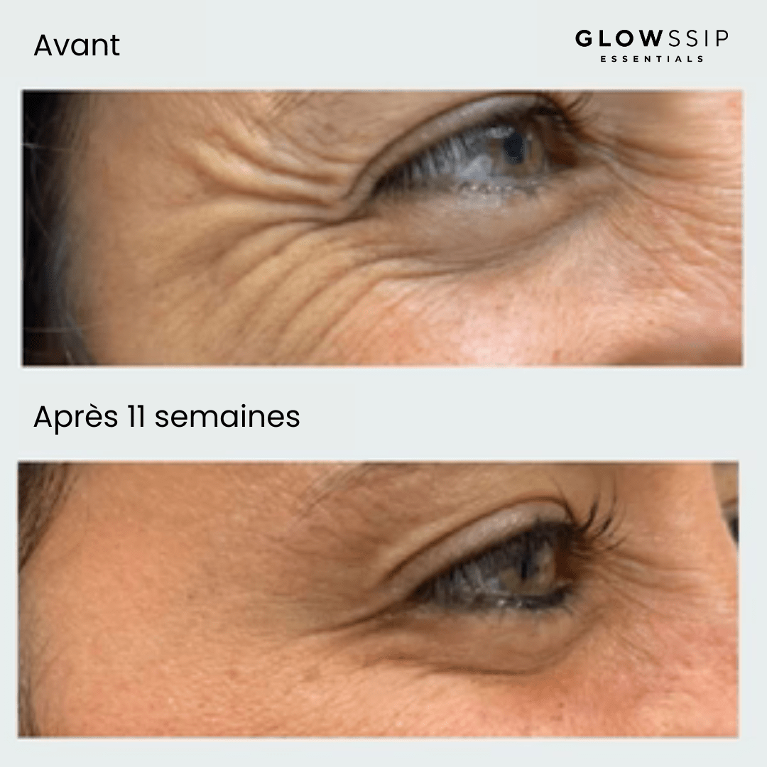 Pack 6 Patches Micro Infusion Ultra-Ciblés