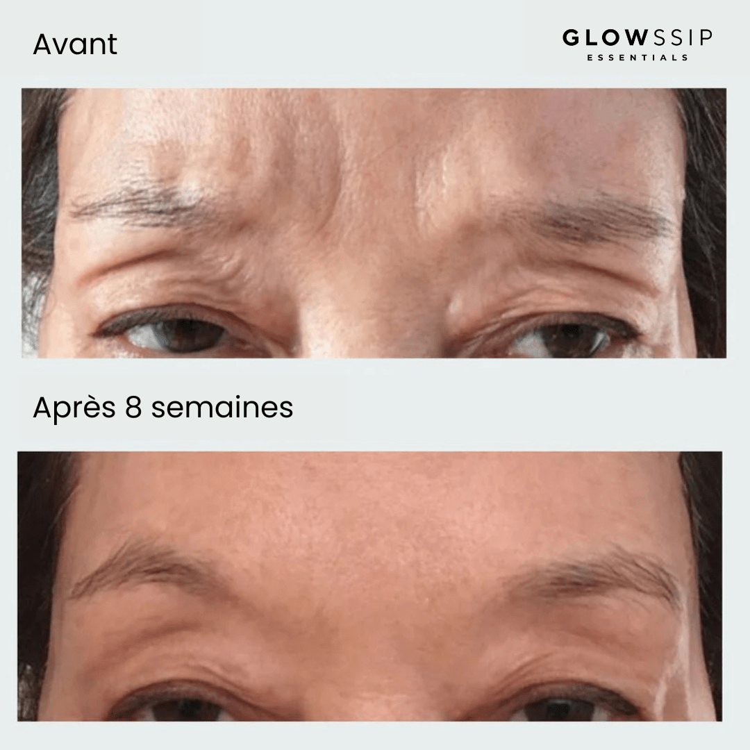 Pack 6 Patches Micro Infusion Ultra-Ciblés