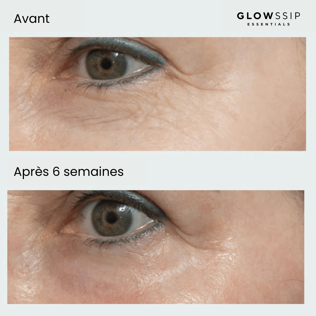 Pack 6 Patches Micro Infusion Ultra-Ciblés