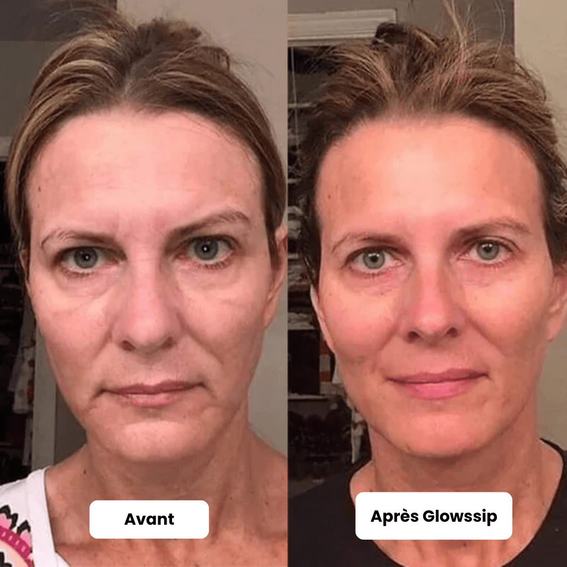 Pack Micro Infusion 3 MOIS