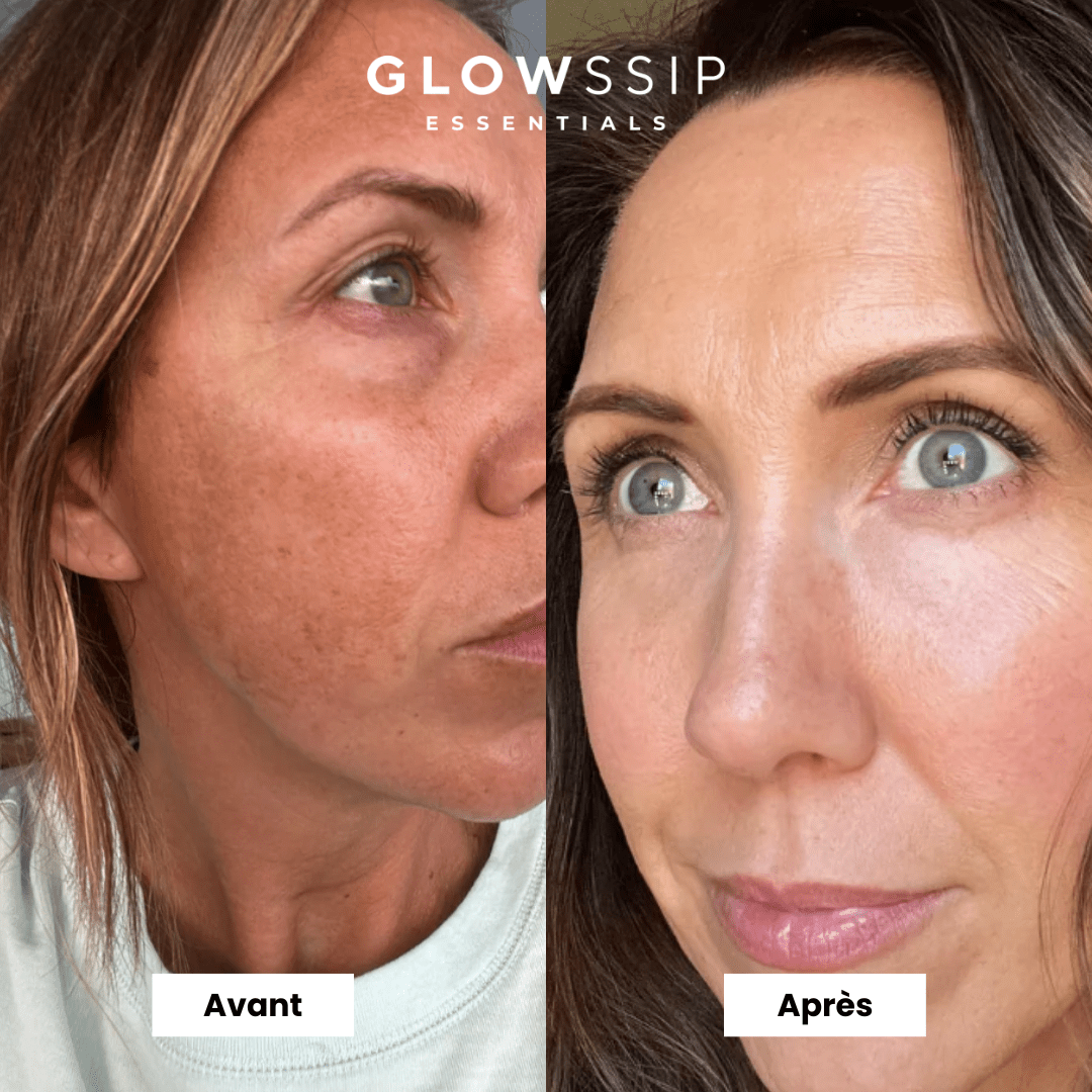 Pack 9 Masques Micropeptides229®