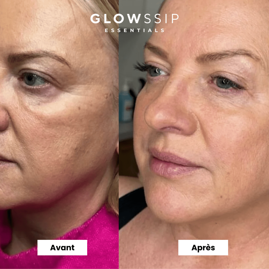 24 Masques Bio-Collagène