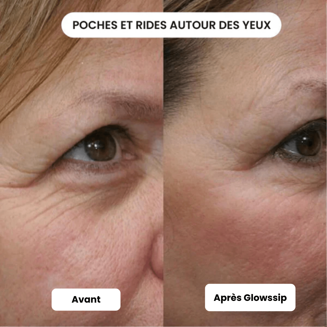 Pack Micro Infusion 3 MOIS