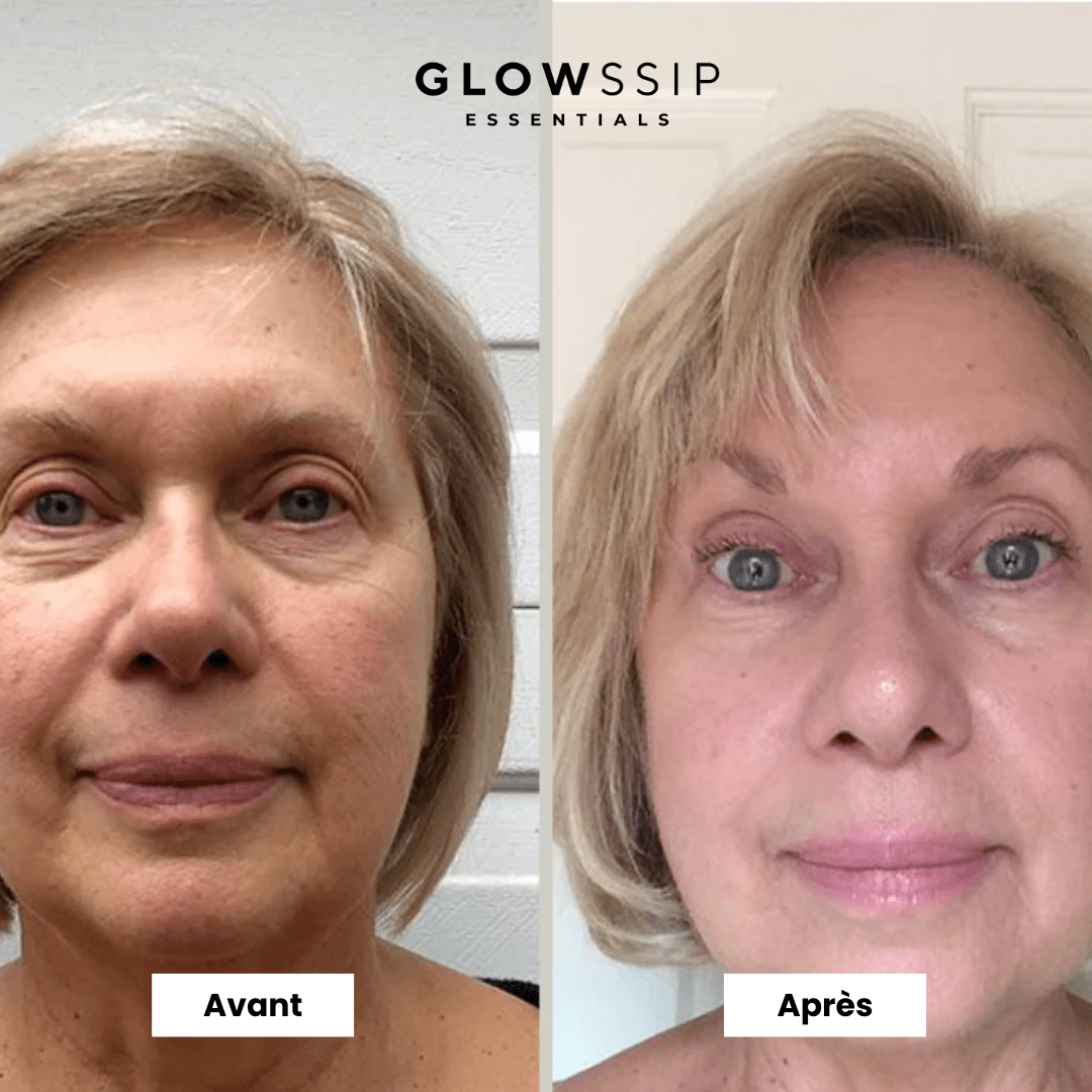 Pack 9 Masques Micropeptides229®