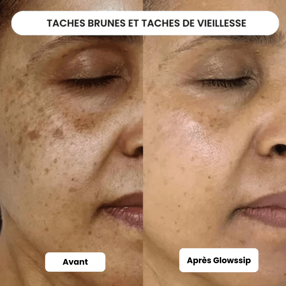 Pack Micro Infusion 3 MOIS