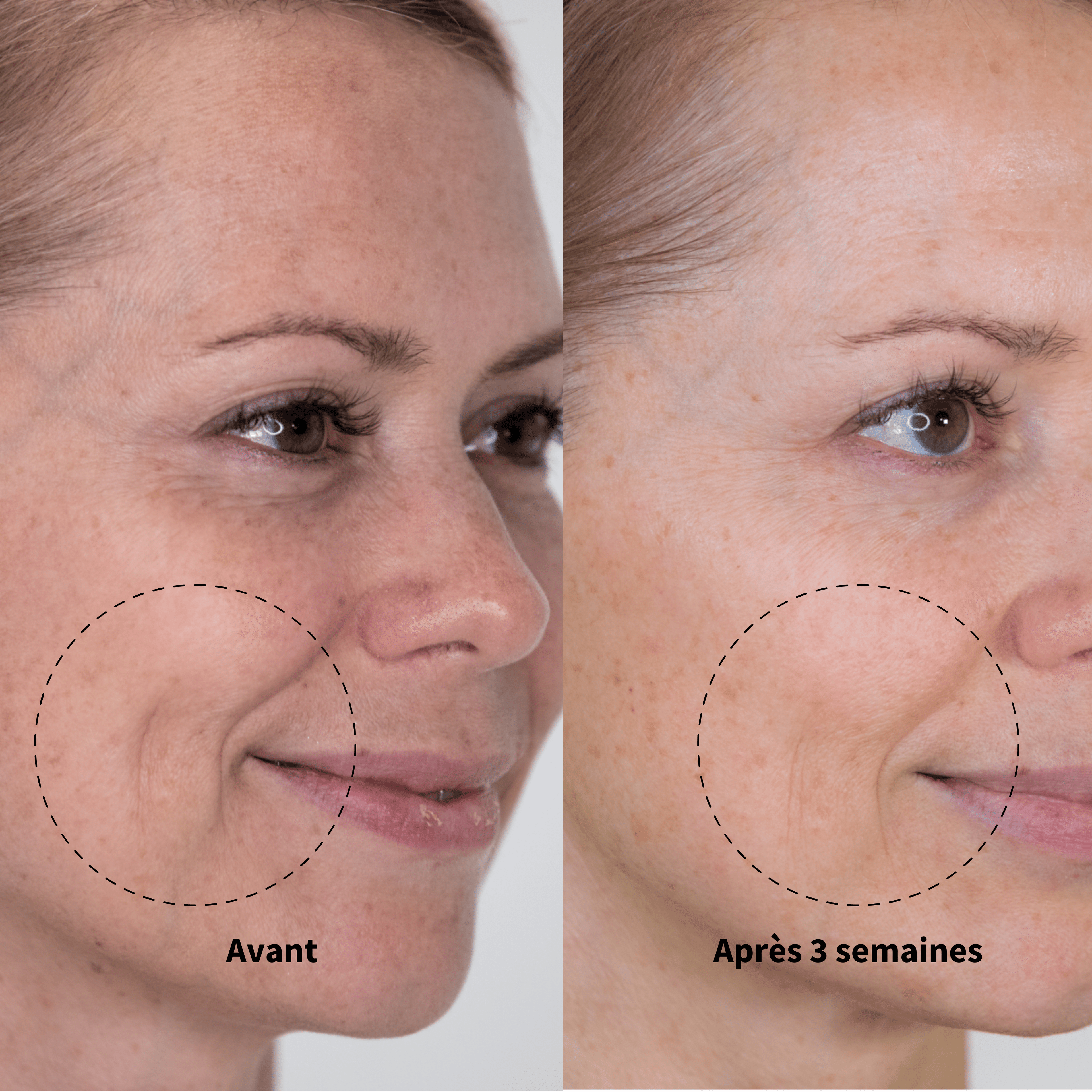 24 Masques + 4 Cadeaux Offerts: La Routine Complète