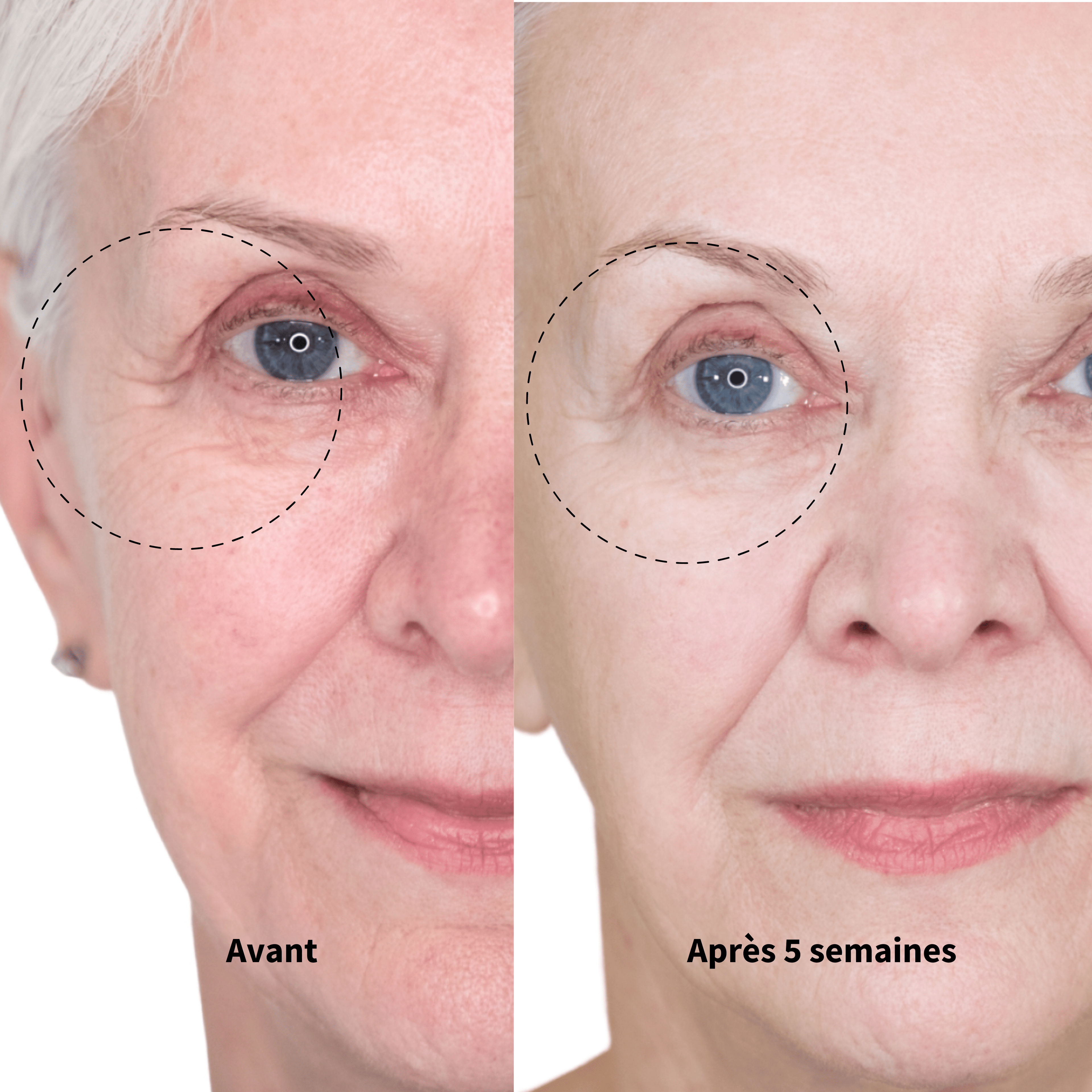 24 Masques + 4 Cadeaux Offerts: La Routine Complète