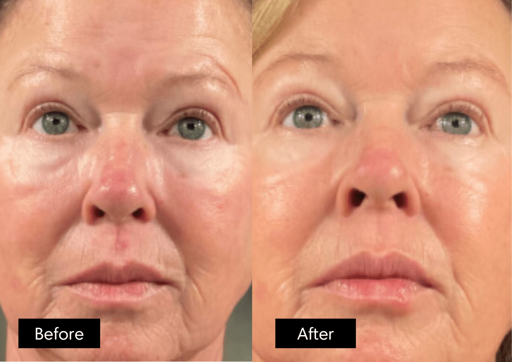 24 Masques + 4 Cadeaux Offerts: La Routine Complète