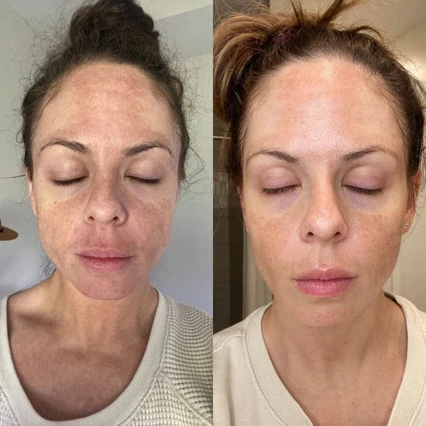 Micro Infusion Pro Anti-Taches