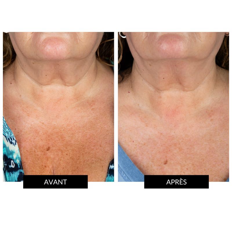 Masque cou et décolleté Micropeptides229®