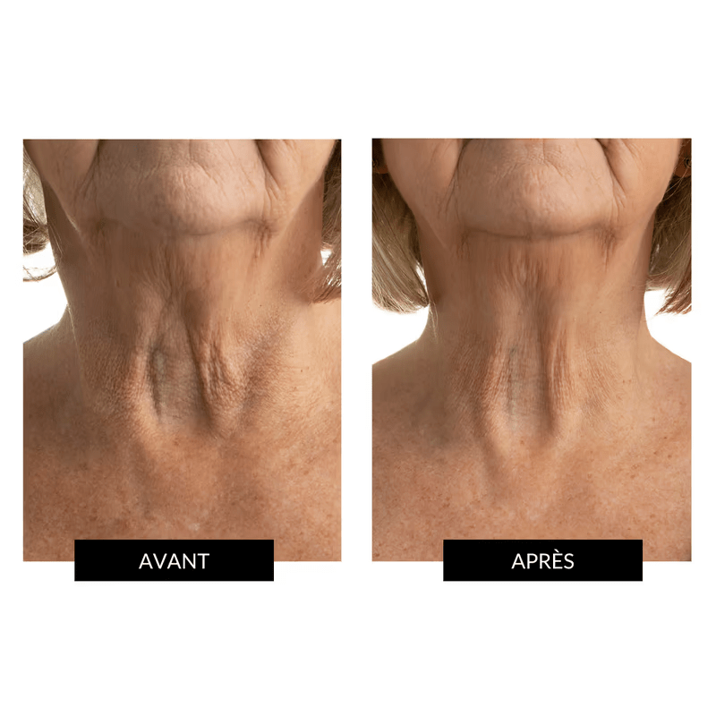 Masque cou et décolleté Micropeptides229®