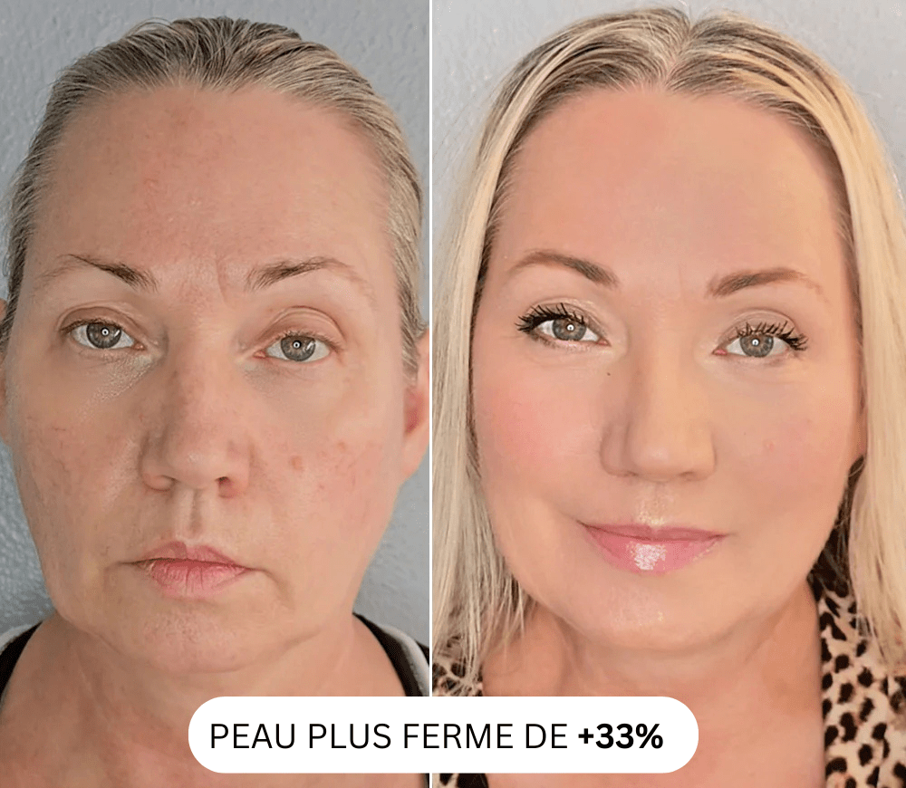 Micro Infusion Pro Anti-Taches