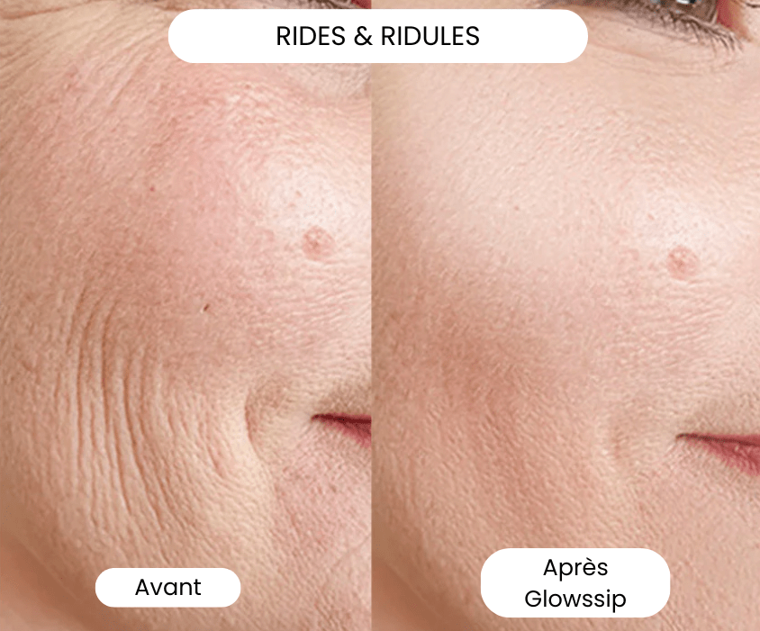 La Routine Complète Micro-Infusion Lift Pro®