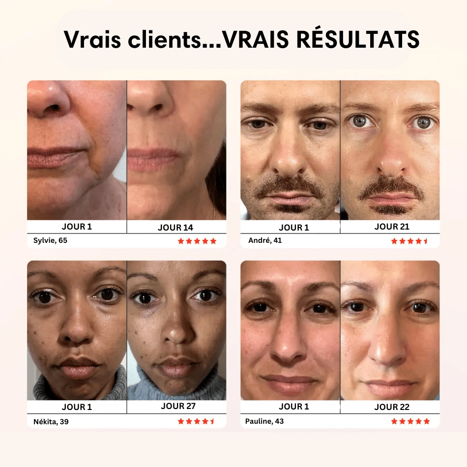 Micro Glow Pro RED LIGHT: Anti-Relâchement