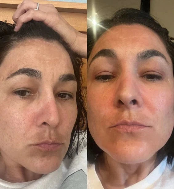 Micro Infusion Pro Anti-Taches