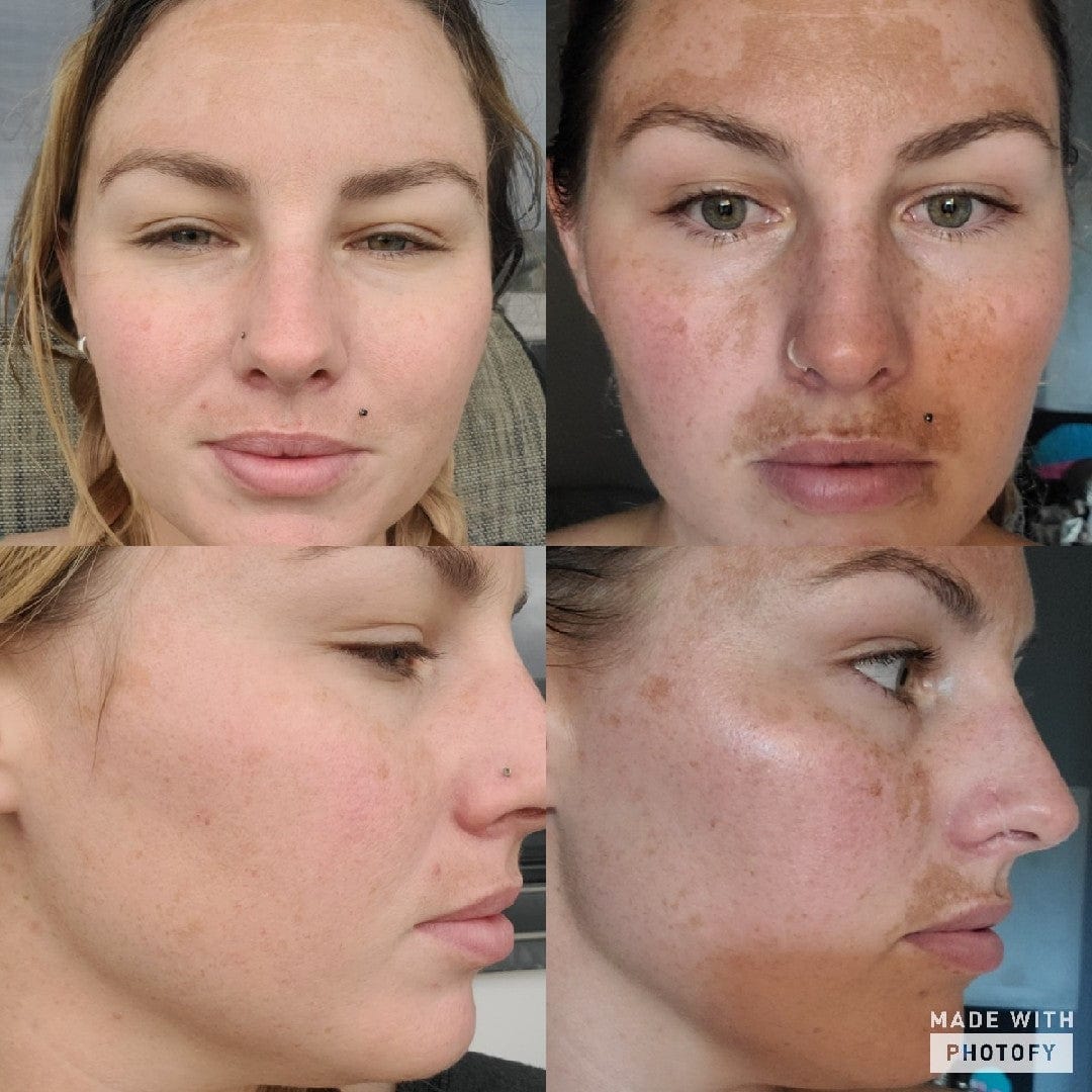 Micro Infusion: -65% +4 Cadeaux Offerts Aujourd&