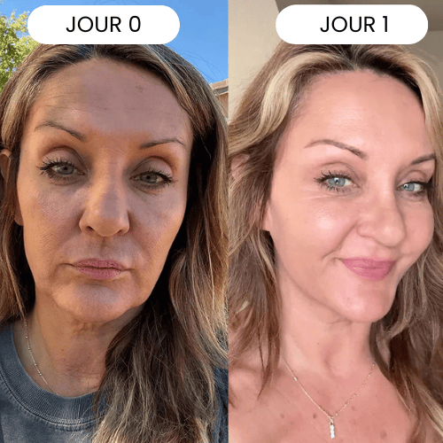 La Routine Complète Micro-Infusion Lift Pro®