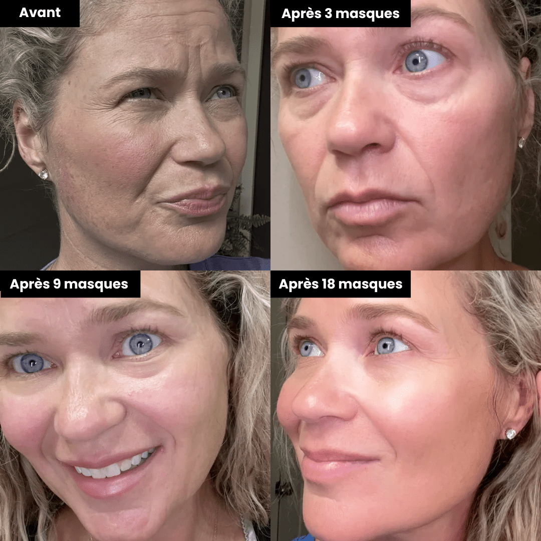 Pack 9 Masques Micropeptides229®