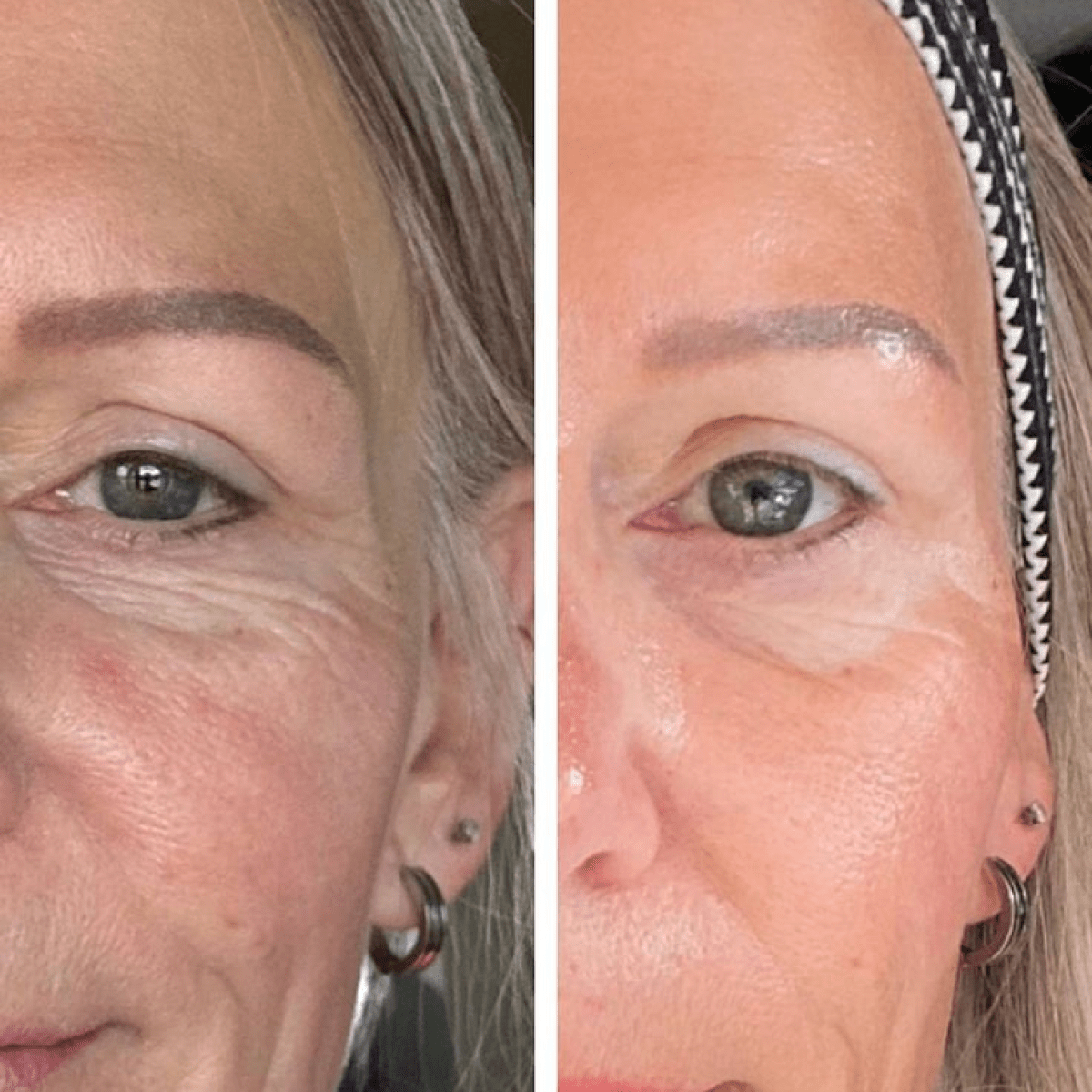 Micro Infusion: -65% +4 Cadeaux Offerts Aujourd&