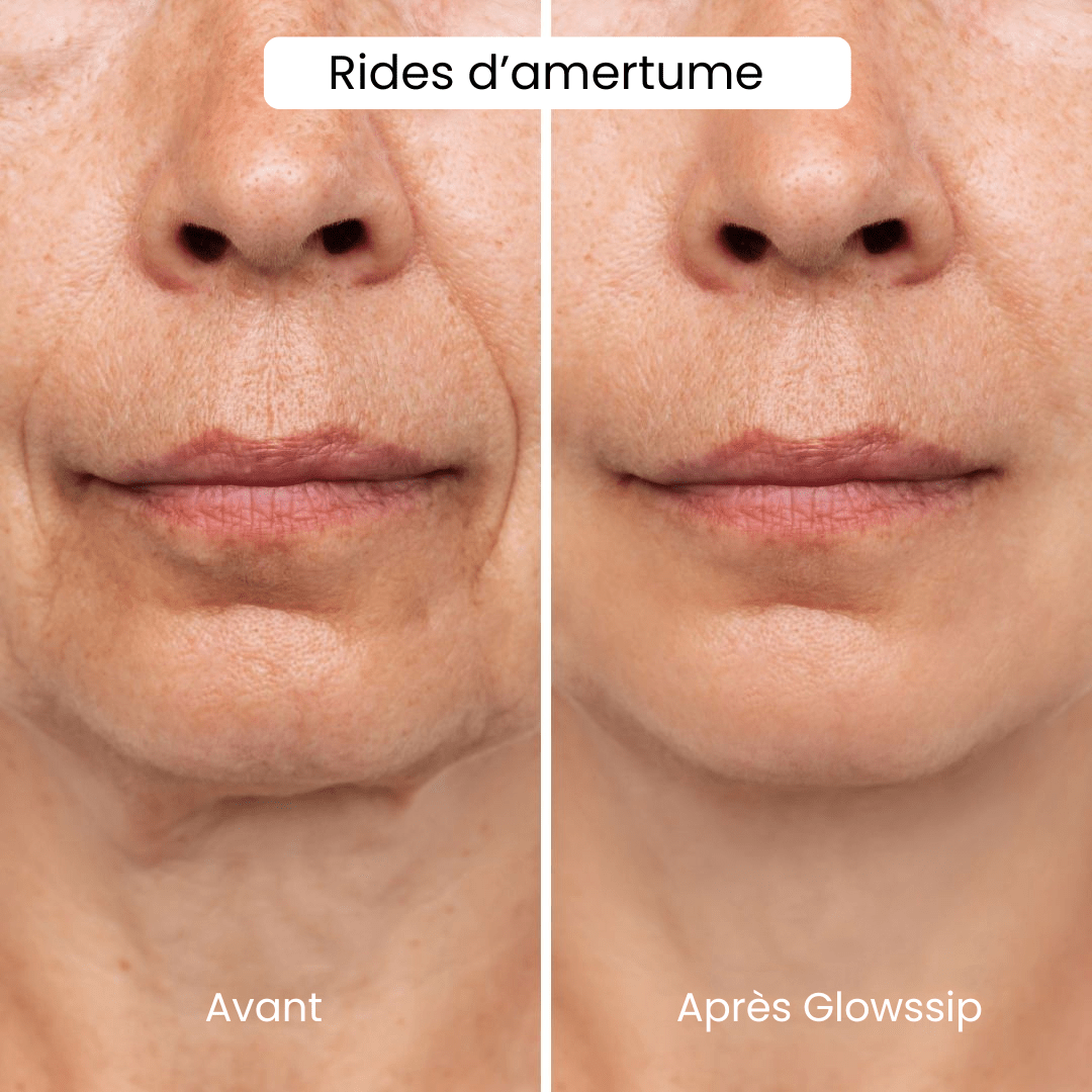 La Routine Complète Micro-Infusion Lift Pro®