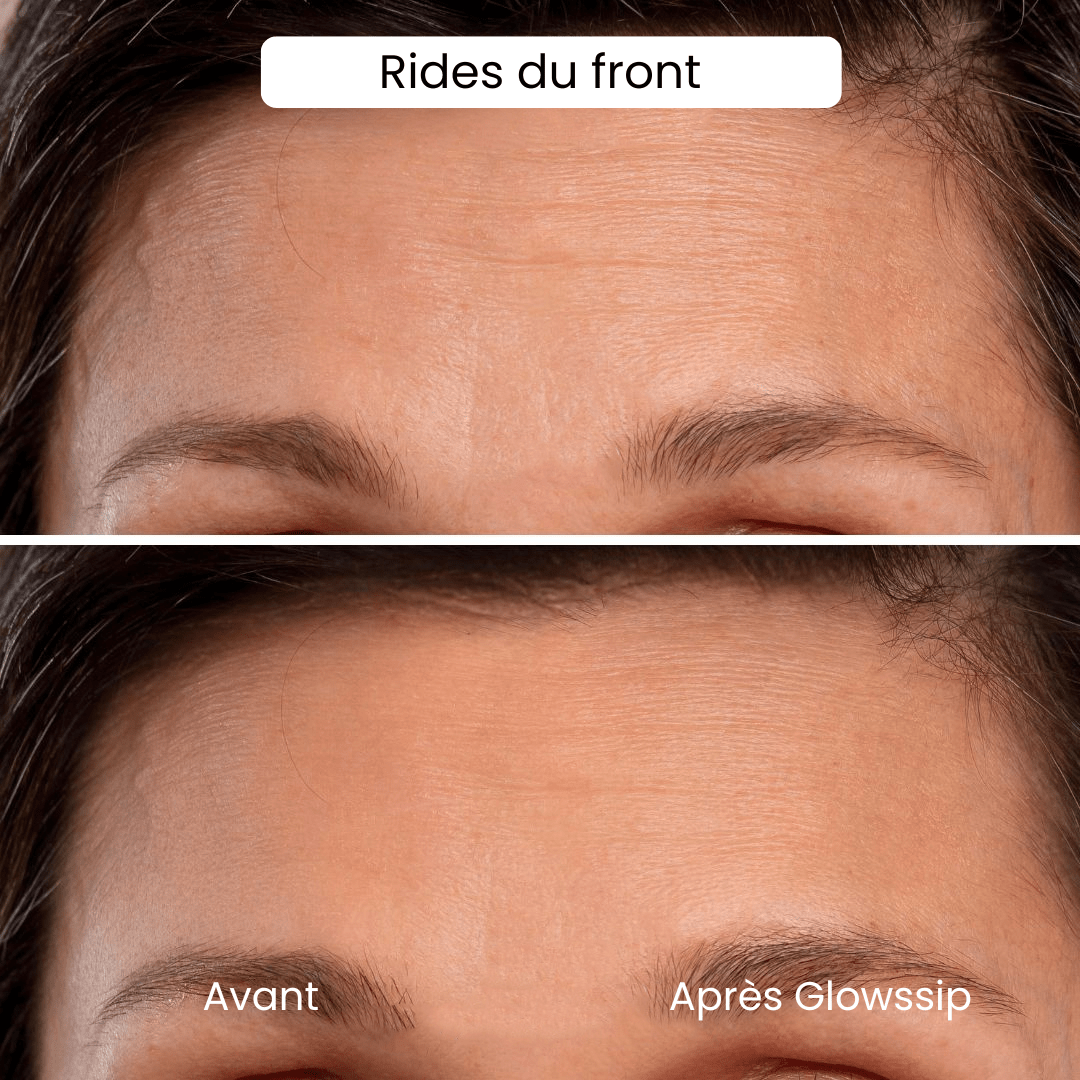 Micro Infusion: -65% +4 Cadeaux Offerts Aujourd&