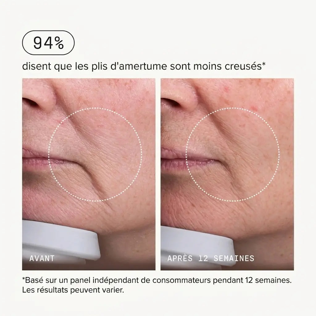 Micro-Infusion Lift Pro®