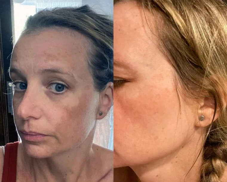 Micro Infusion Pro Anti-Taches