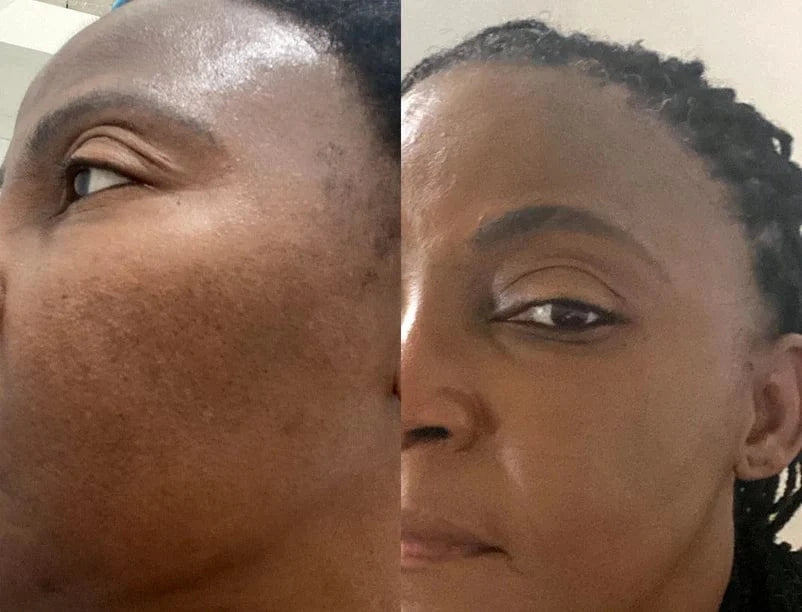 Micro Infusion Pro Anti-Taches