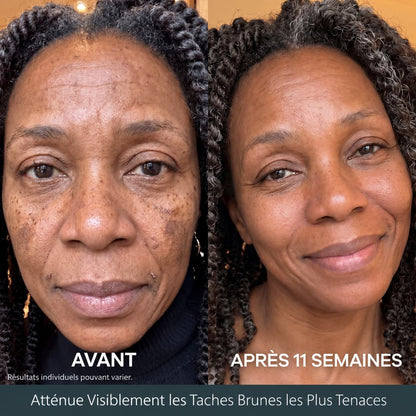 Micro-Infusion Anti-Taches 3 Mois