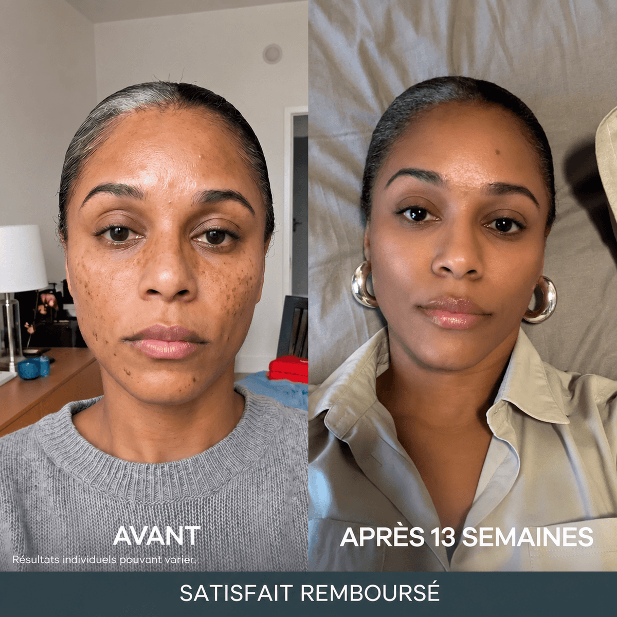 Micro-Infusion Anti-Taches 3 Mois