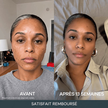 Micro-Infusion Anti-Taches 3 Mois