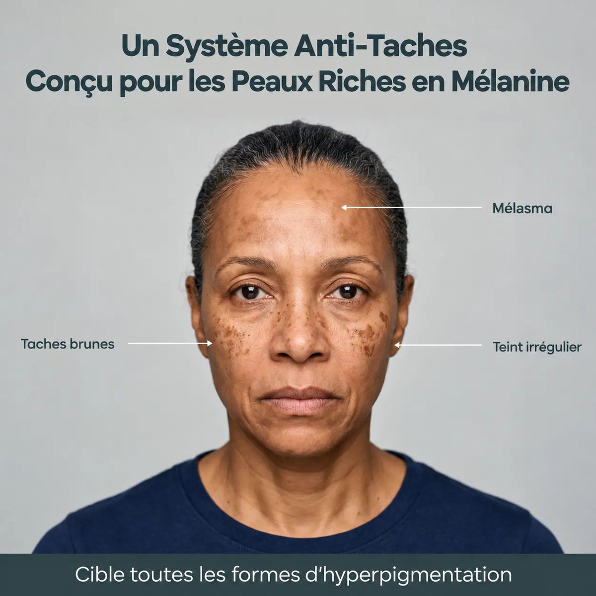 Micro-Infusion Anti-Taches 3 Mois