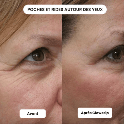 Micro Infusion: -65% +3 Cadeaux Offerts