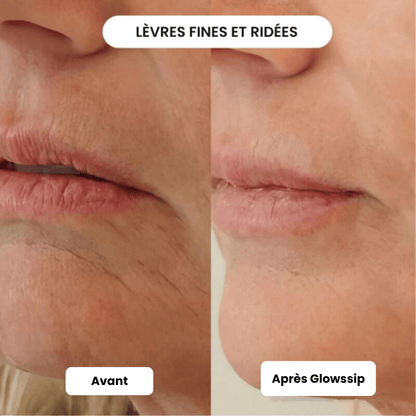 Micro Infusion: -65% +3 Cadeaux Offerts