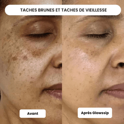 Micro Infusion: -65% +3 Cadeaux Offerts