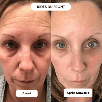 Micro Infusion: -65% +3 Cadeaux Offerts