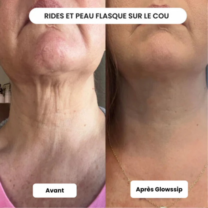 Pack Micro-Infusion 4 Mois ( Anti-Rides + Anti-Tâches)