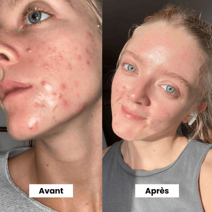 Micro Infusion: -65% +4 Cadeaux Offerts Aujourd&