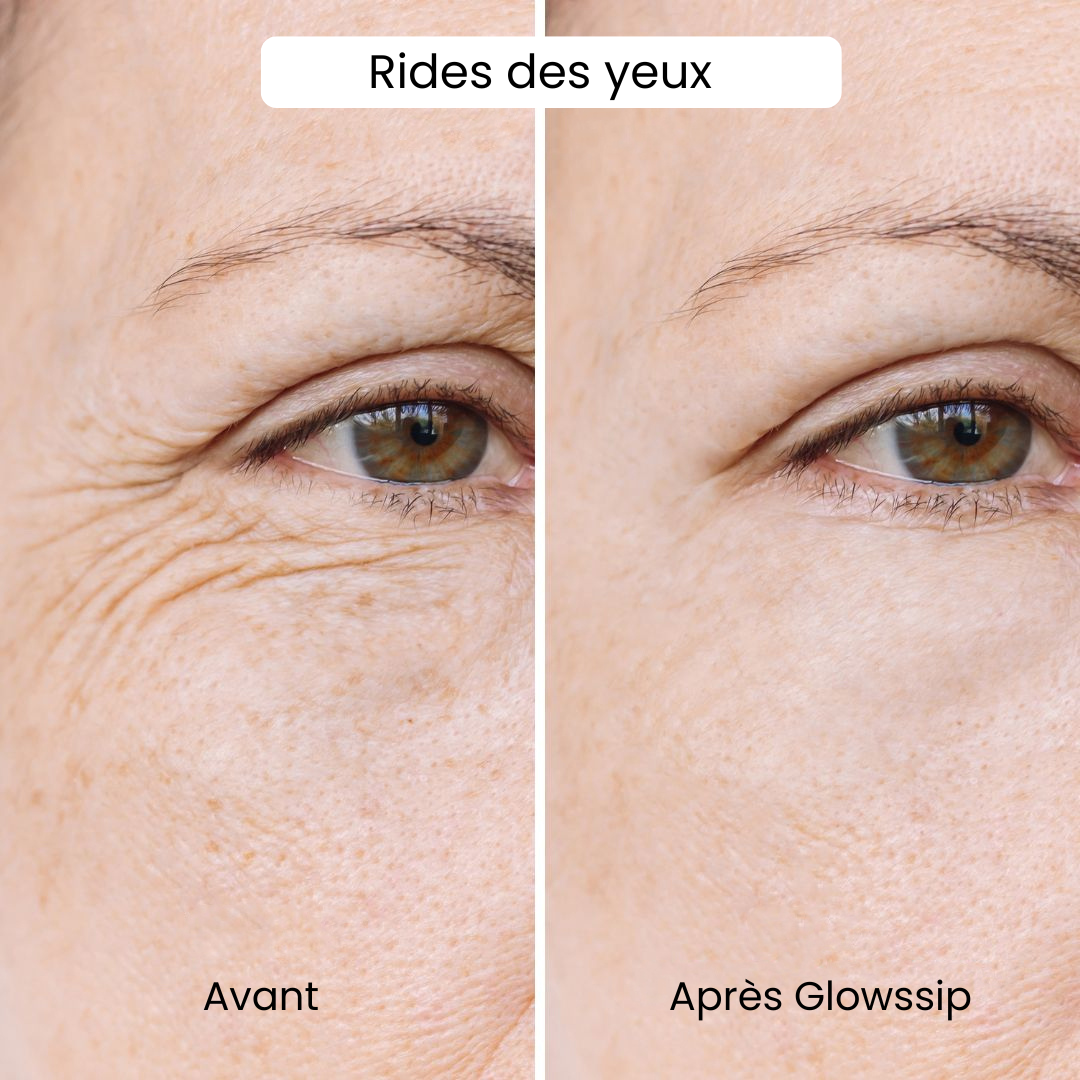 Micro Infusion: -65% +4 Cadeaux Offerts Aujourd&