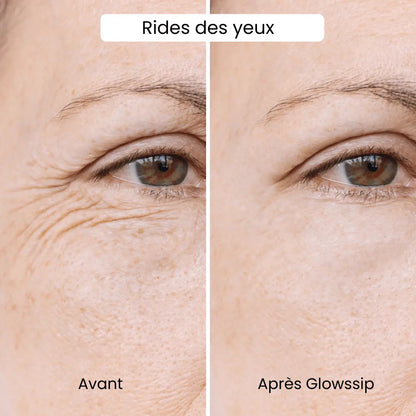 La Micro-Infusion Lift Pro®