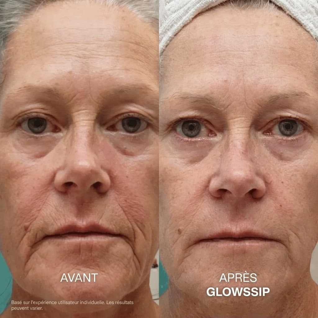 La Micro-Infusion Lift Pro®