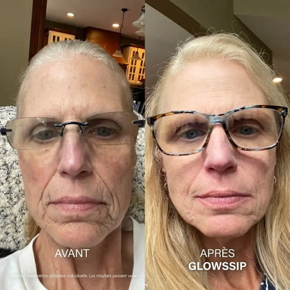 Micro-Infusion Lift PRO®