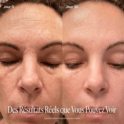 Stick Repulpant Bio-Collagène PDRN