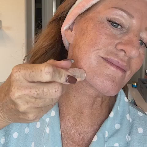 Micro-Infusion Lift Pro®