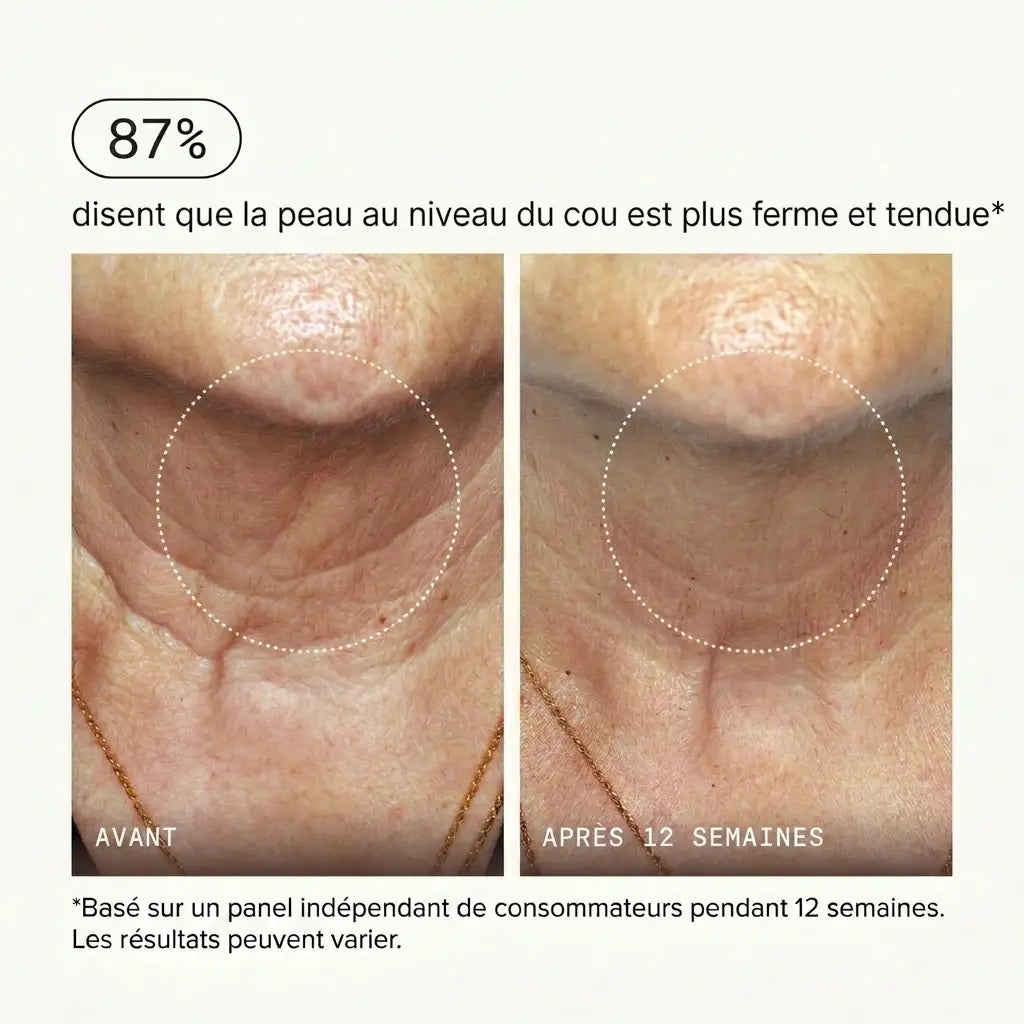 Micro-Infusion Lift Pro®